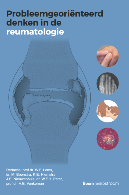 PGD reumatologie Boom