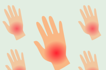 Van gezwollen vinger naar PsA-diagnose: klinisch redeneren in de reumatologie