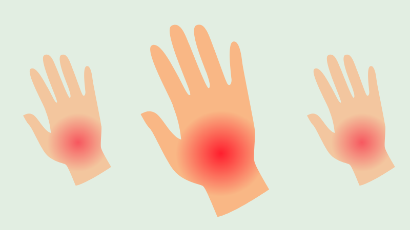 Van gezwollen vinger naar PsA-diagnose: klinisch redeneren in de reumatologie